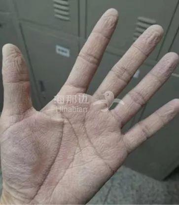 ..