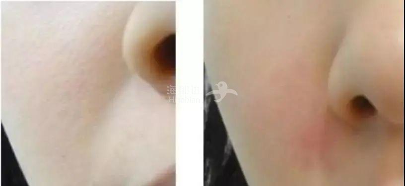 ..