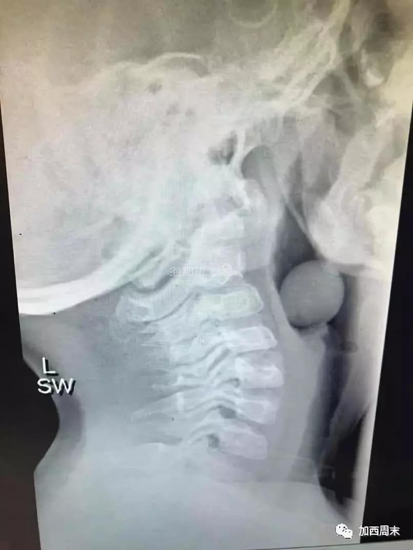 ..
