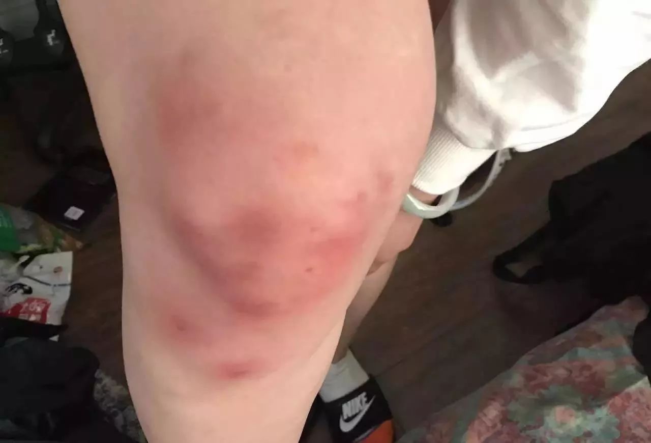 ..