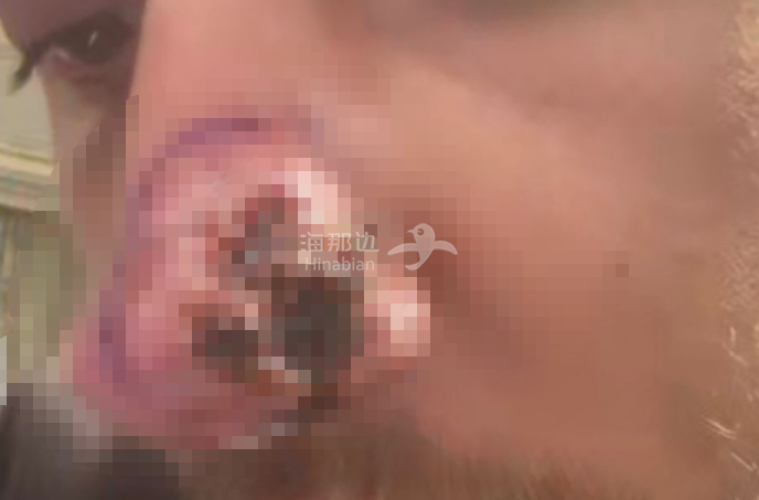 ..