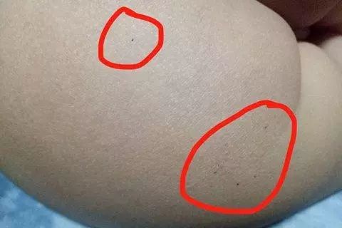 ..