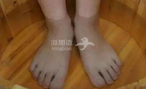 ..