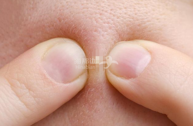 ..