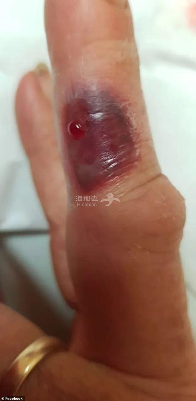 ..