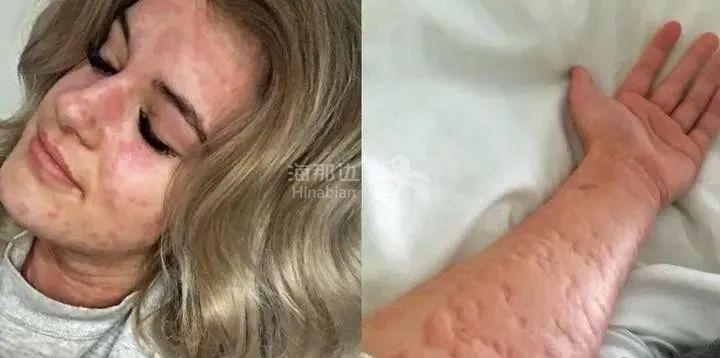 ..