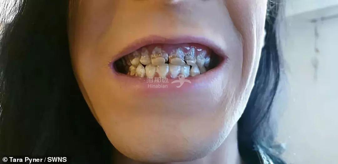 ..