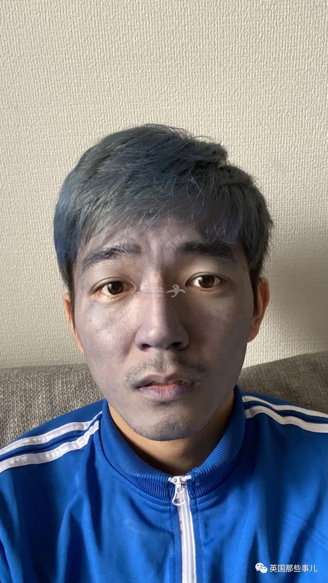 ..