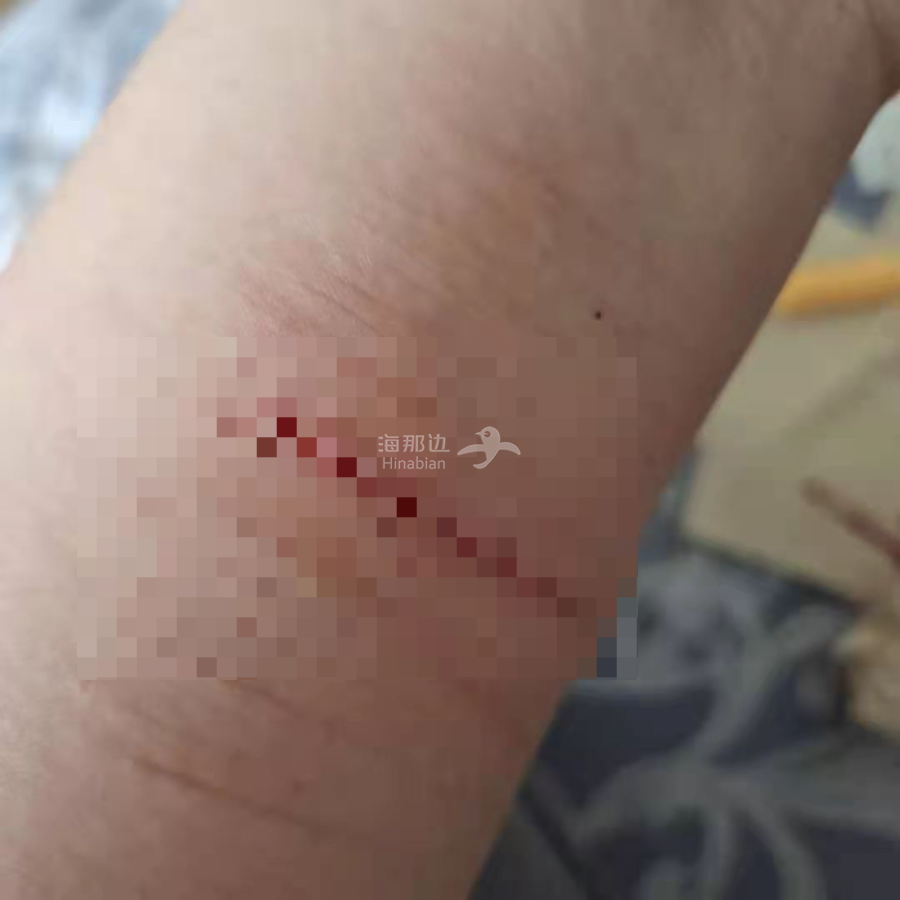 ..