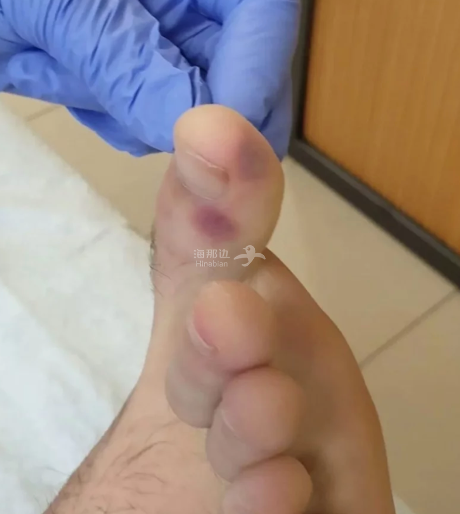 ..