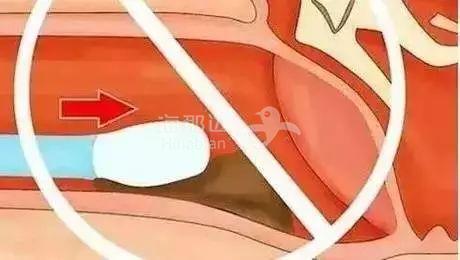 ..