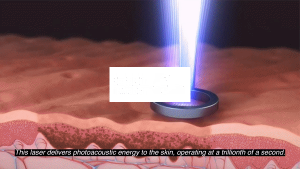 ..