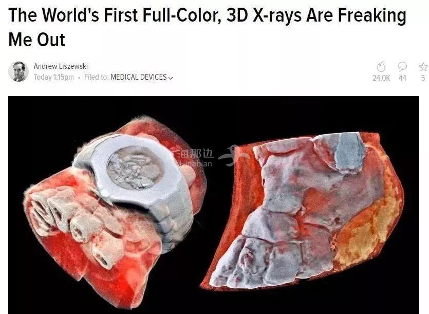 ..