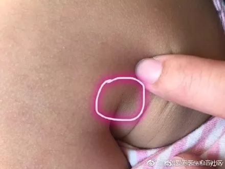 ..