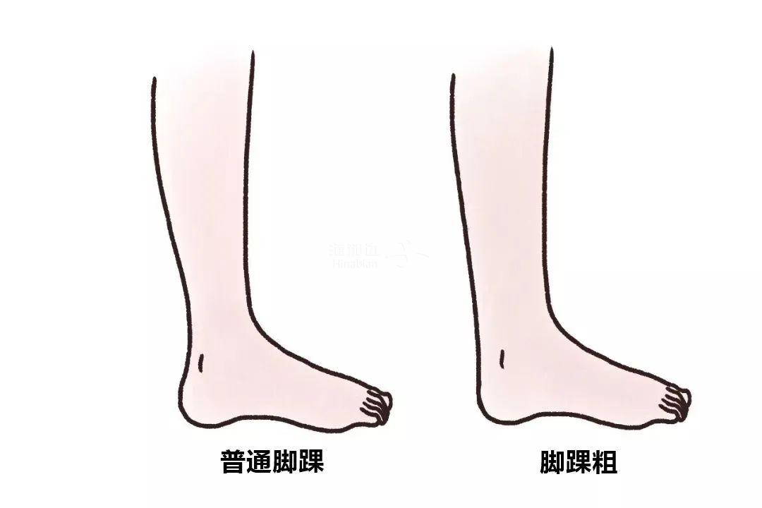 ..