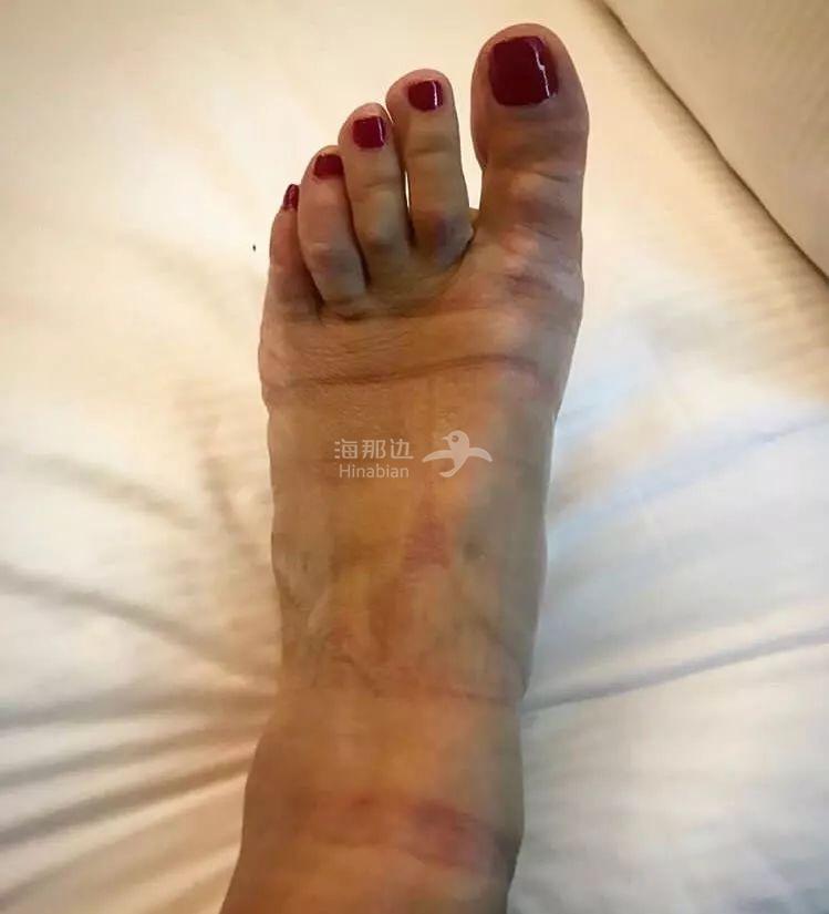 ..