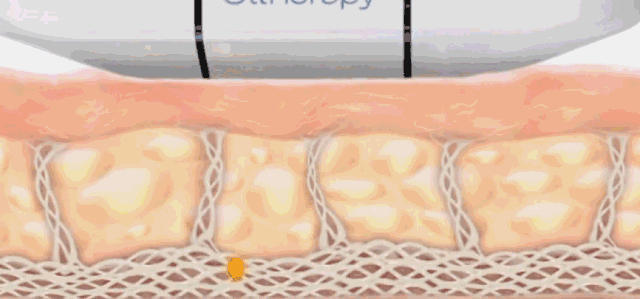 ..