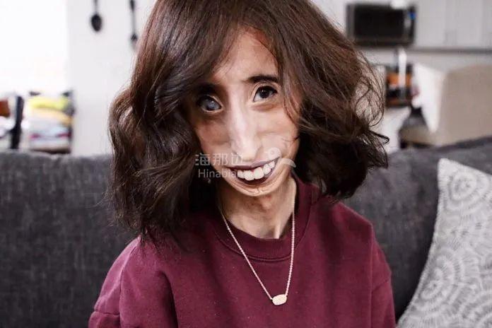 ..