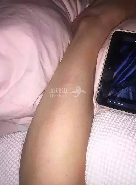 ..