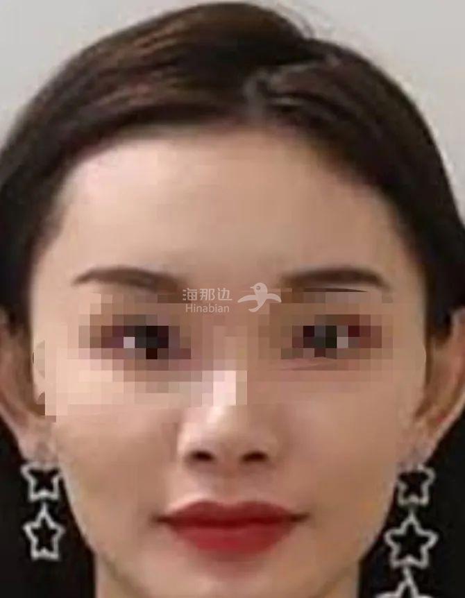..