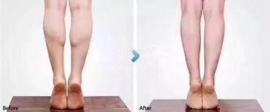 ..