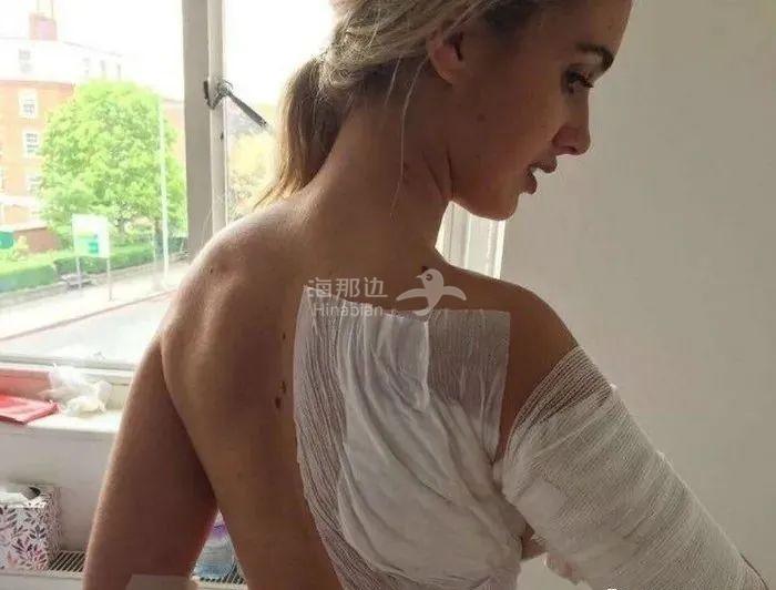 ..