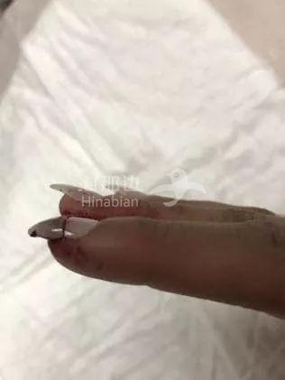 ..