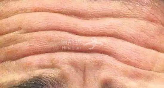 ..