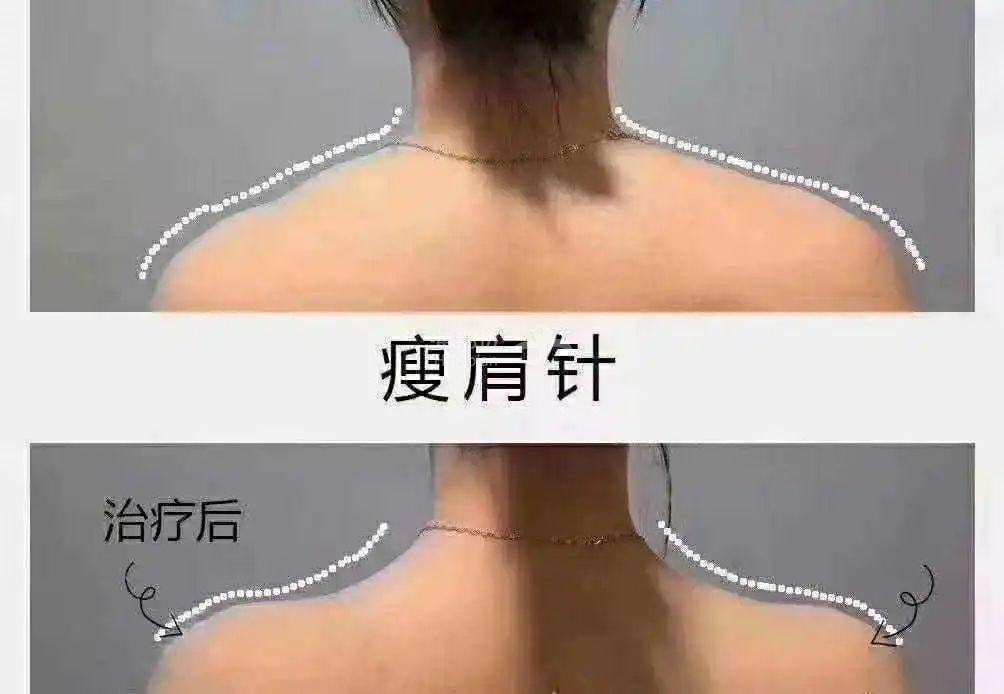 ..