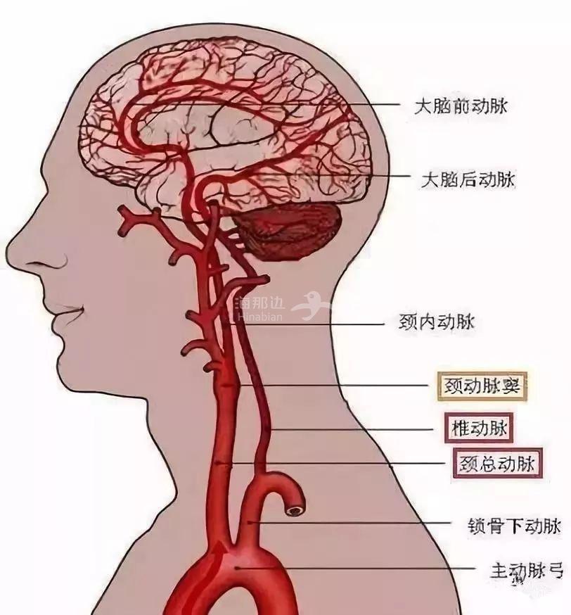 ..